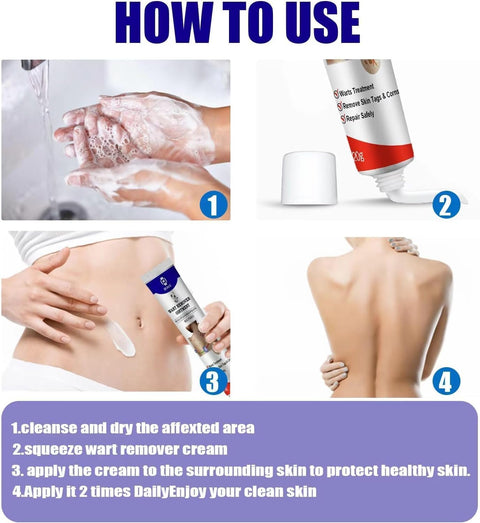 Wart Remover Ointment